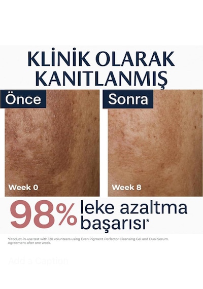 Eucerin Even Pigment Perfector Dual Serum 30 Ml Leke Karşıtı, Cilt Tonu Eşitleyici Ve Kırışıklık Karşıtı Yüz Serumu