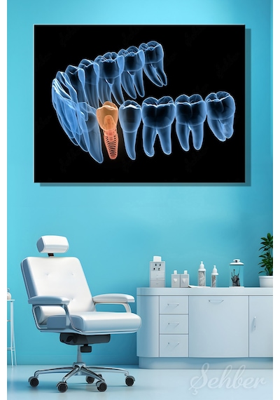 Premolor Dişin İmplant Tedavisi 3d Tıbbi Çizim Yatay Kanvas Tablo Tekli Ağız Diş Sağlığı 3480