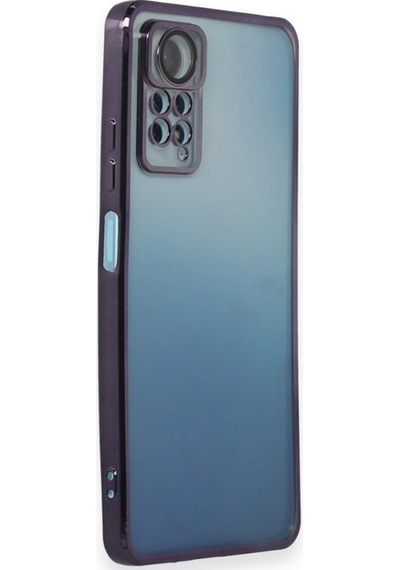 Xiaomi Redmi Note 11 / 11s Kılıf Razer Lens Çerçeveli Silikon Kapak