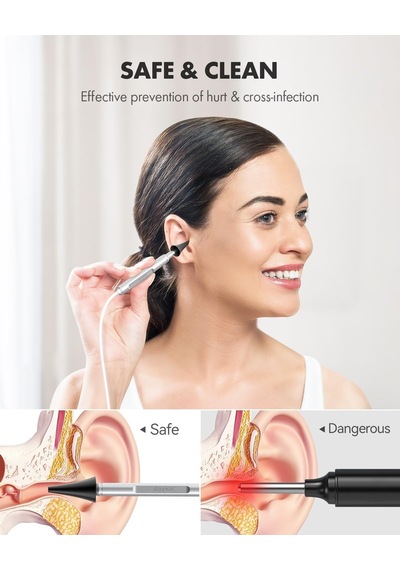 Anykit Usb Otoskop 3.9mm Ultra Net Kulak Kamerası - İphone/android/pc