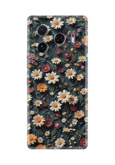 Camon 30 Pro 5g Kılıf Hd Baskılı Yüksek Korumalı Xt-camon30pro 2609 Stk-35-30pro