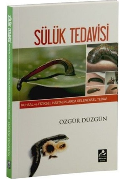 Sülük Tedavisi Özgür Düzgün