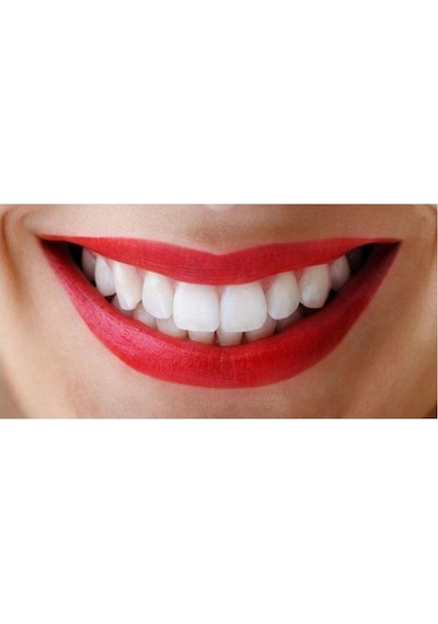 Diamond Dental Diş Beyazlatma ve Parlatma Kremi 110 G