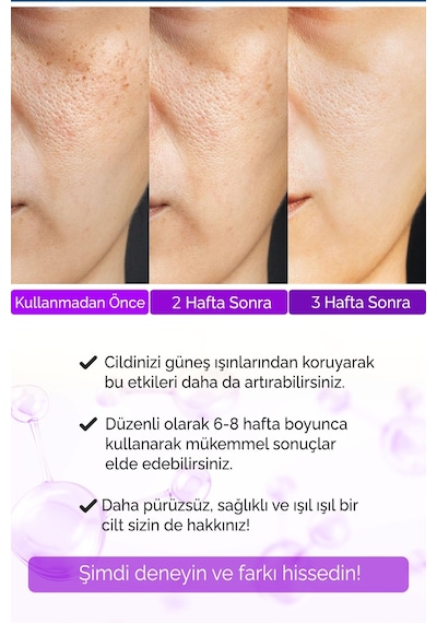 Devida Yaşlanma ve Kırışıklık Karşıtı Göz Çevresi Retinol Serum 30 ML
