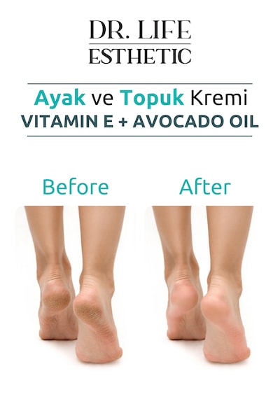 Dr. Life Esthetic Ayak ve Topuk Bakım Kremi 100 ML