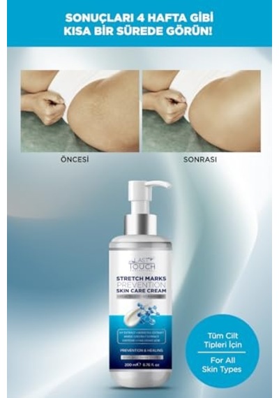 Karşıtı Gül Yağlı Losyon Stretch Marks Removal Lotıon Wıth Rose Oıl 250ml Çok Renkli