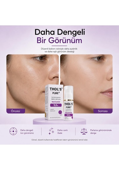 's Pure+ Niacinakarın Bölgesi 5,5% Saf Konsantre Bakım Serumu - 15 Ml
