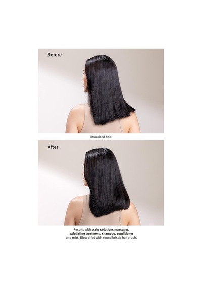 Tr Scalp Solutions Saç Derisi Için Jel Peeling 150ml 018084040508