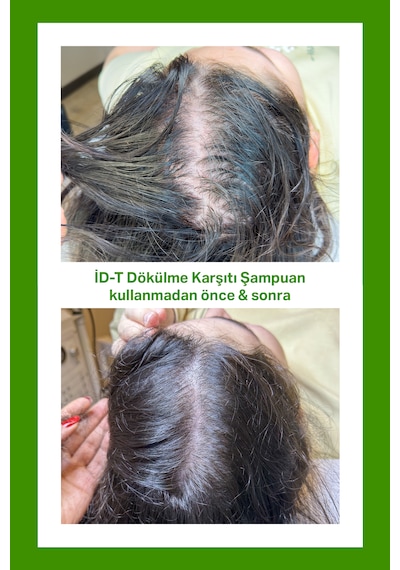 İd-t Hızlı Saç Uzaması Biotin Ve Keratin Dökülme Karşıtı Şampuan 250 ML
