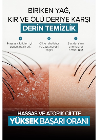 Saç Derisi Peelingi Arındırıcı Ve Dengeleyici Hair Scrub 200 Ml Tüm Saçlar