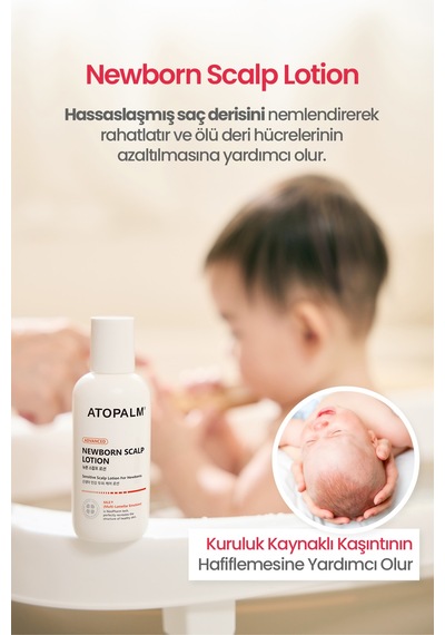 Bebeklere&yenidoğanlara Özel Konak Karşıtı Saç Derisi Losyonu Atopalm Newborn Scalp Lotion