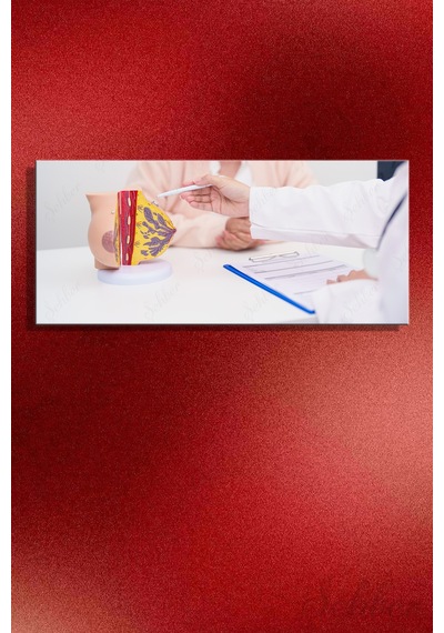 Kanvas Tablo Meme Anatomisi Maketi Açıklama Yapan Doktor Yatay Duvar Tablosu - 4678 Çok Renkli