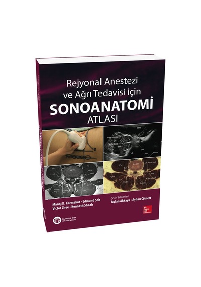Rejyonal Anestezi Ve Ağrı Tedavisi İçin Sonoanatomi Atlası