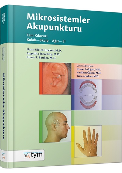 Mikrosistemler Akupunkturu