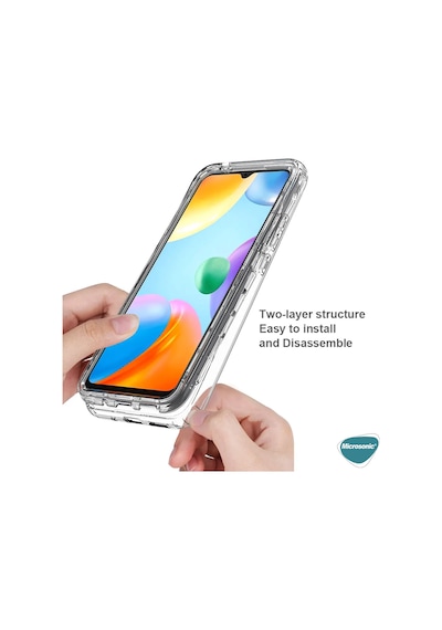 Microsonic Xiaomi Mi 14 Pro Kılıf 6 Tarafı Tam Full Koruma 360 Clear Soft Şeffaf -