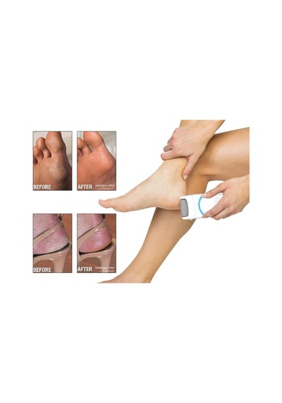 Personal Pedi Ayak Topuk Temizleyici