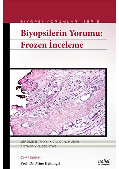 Biyopsilerin Yorumu: Frozen İnceleme- Nobel Tıp Kitabevleri
