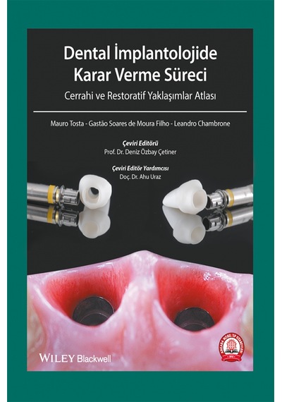 Dental İmplantolojide Karar Verme Süreci Cerrahi Atlası