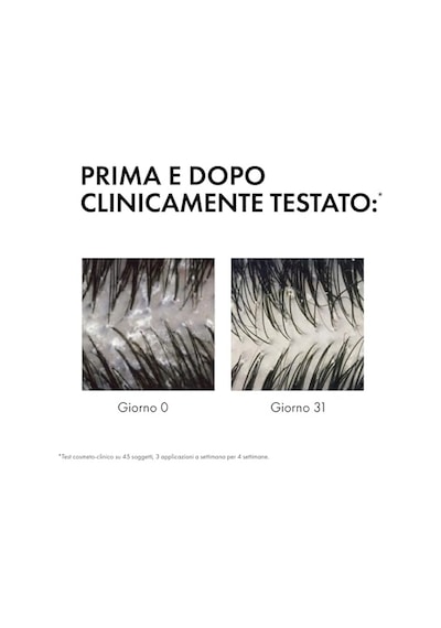 Dercos Anti Dandruff Normal Ve Yağlı Saçlar İçin Kepek Karşıtı Bakım Şampuanı 390 Ml