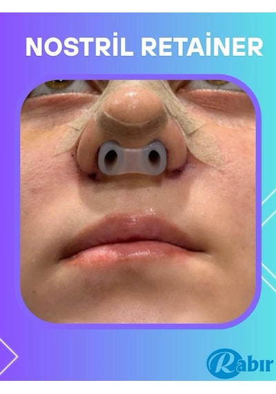 Rabır Nostril Retainer Burun Deliği Şekillendirici 8-8