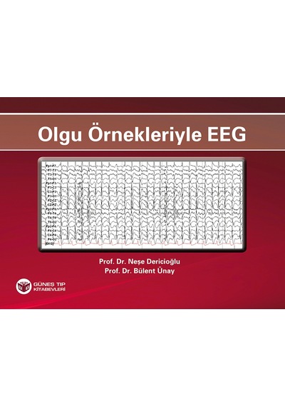 Olgu Örnekleriyle Eeg