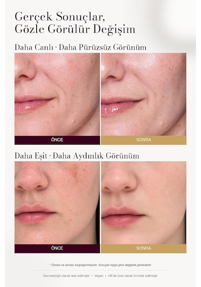 Leke Karşıtı Ve Aydınlatıcı C Vitamini Serum 30ml Arbutin, Tranexamic Asit, Niacinamide, Hyalüronik Asit - Gözenek Sıkılaştırıcı Etki