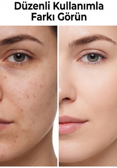 Yaşlanma Karşıtı 3 Etkili Antı Agıng Kolajen Serum 30 Ml
