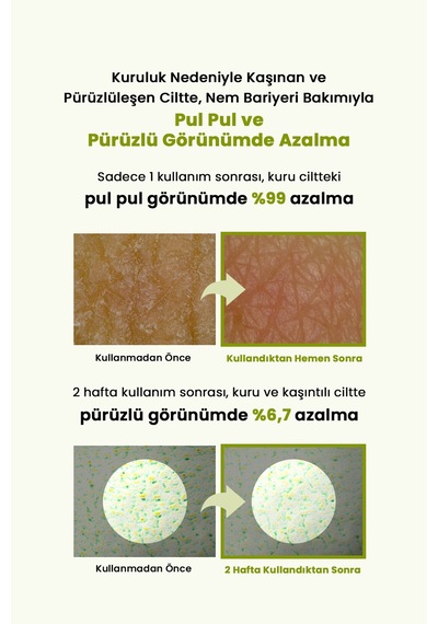 Aşırı Kuru Hassas Cilde Bariyer Desteği Sunan Yoğun Nemlendirici Krem Zeroıd Intensive Cream