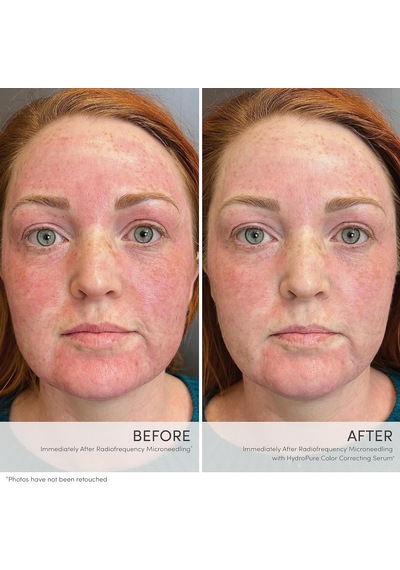 Hydropure Color Correcting Serum
