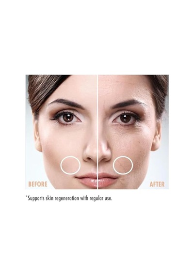 Maruderm Retinol%0.3 Su Bazlı Cilt Yenileyici Bakım Serumu Bakuchiol, Q10 & Yeşil Çay İle İnce Çizgi Karşıtı, Aydınlatıcı Yüz Serumu, 30 Ml