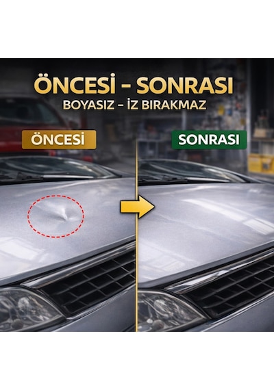 Polham 20 Parça Boyasız Göçük Düzeltme Seti Kaput Kapı Çamurluk Göçük Onarım Aparatı Pdr Dent Repair Seti