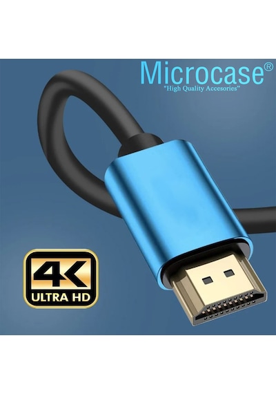 Microcase Yüksek Hızlı 4k Ultra Hd Hdmı Kablo 3 Metre - Al3772