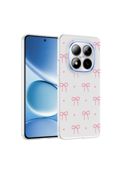 Redmi Note 15 Pro 4g Kılıf Kamera Korumalı Desenli Zore Klip Kapak - Fiyonk
