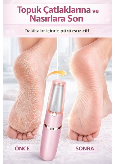 Şarjlı Ayak Törpüsü Pedikür Ayak Bakım Aleti Ayak Tabanı Bakım Törpüsü Topuk Nasır Temizleme