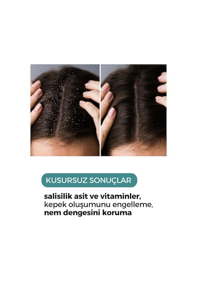 Zento Kepek Karşıtı Saç Bakım Toniği 150 ML