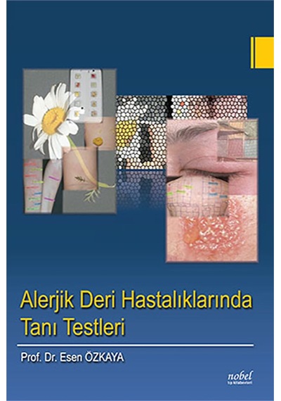 Alerjik Deri Hastalıklarında Tanı Testleri- Nobel Tıp Kitabevleri