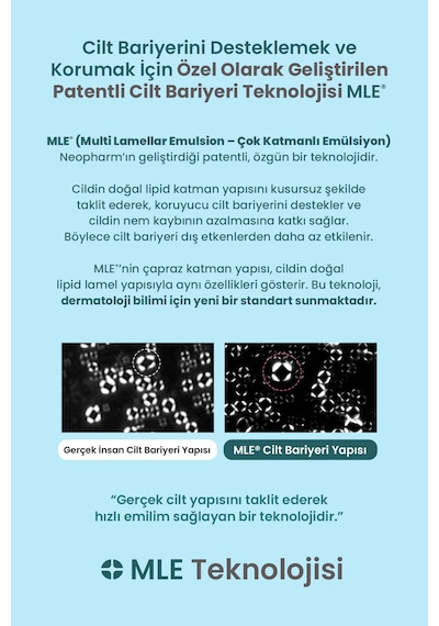 Hassas Cildi Nemlendirerek Rahatlatan Ve Ferahlık Hissi Sunan Jel Losyon Atopalm Soothing Gel Lotion