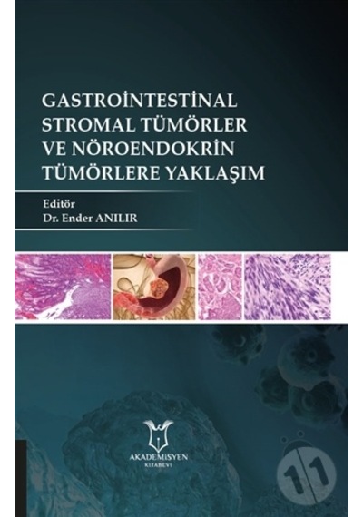Gastrointestinal Stromal Tümörler Ve Nöroendokrin Tümörlere Yakla