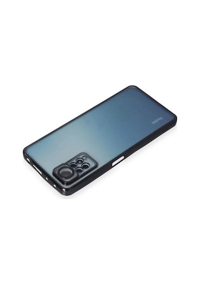 Newface Xiaomi Redmi Note 11 Pro Kılıf Razer Lensli Silikon - Siyah