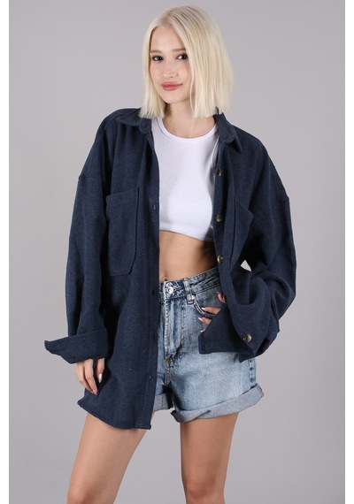 Madmext Lacivert Oversize Gömlek Ceket Mg1562 Lacivert