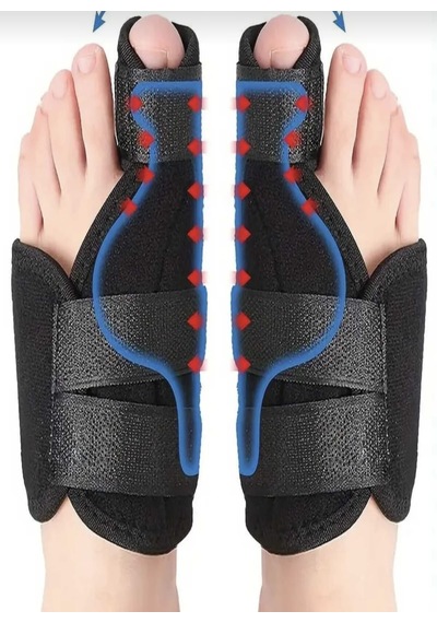 Medikal Halluks Valgus Gece Ateli Ayak Baş Parmak Bunyon Koruyucu 1 Çift Sağ Ve Sol