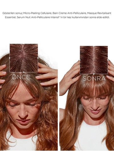 Symbiose 3 Step Anti-dandruff System For Dry Scalps