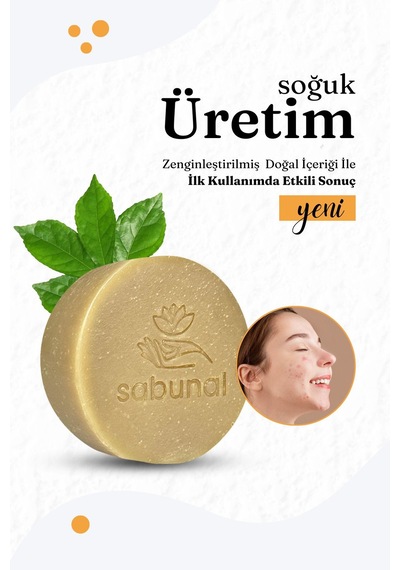 Sabunal Niacinamide Sabunu - Aydınlatıcı - Siyah Nokta ve Akne Sabunu 100 G