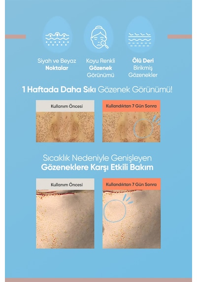 Cilde Aydınlık Ve Pürüzsüz Görünüm Kazandıran Gözenek Karşıtı Krem A'pıeu Egg Pha Pore Cream 11598371