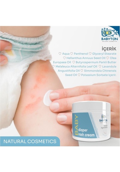 Babyton Pişik Önleyici Krem 50 ML