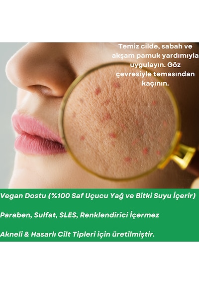 Sera Natura Acne Care Akne Karşıtı Cilt Bakım Yağı 20 ML