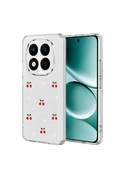 Note 15 Pro Plus 5g Fiyonk Desenli Kapak - Desen 9
