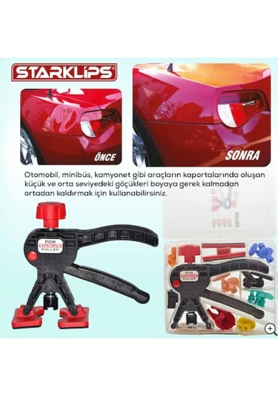 Boyasiz Göçük Düzeltme Set Çanta Pensesi Renkli + 24 Adet Pdr Göç 523075184