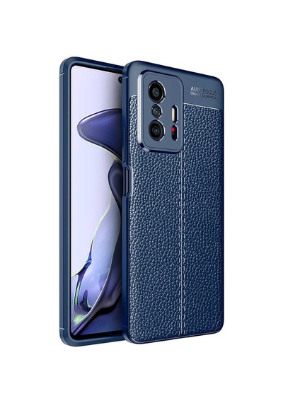 Xiaomi Mi 11T 5G Kılıf Zore Niss Deri Desenli Silikon Kılıf