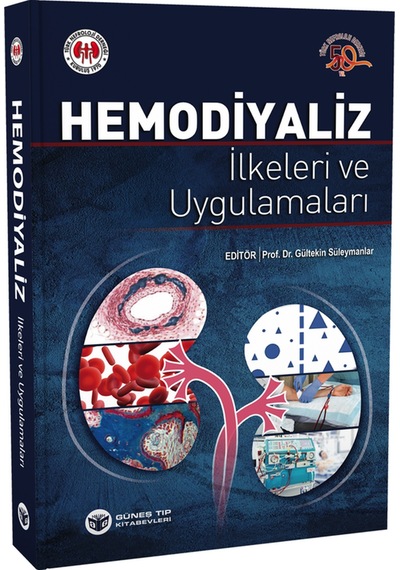 Hemodiyaliz İlkeleri Ve Uygulamaları